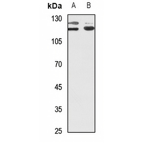 PPP1R13B Rabbit Polyclonal Antibody