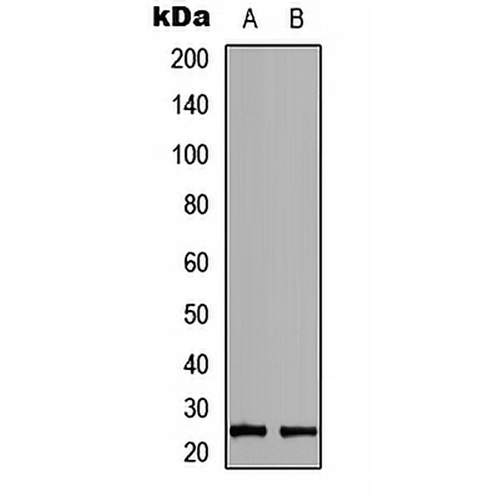 RAB39B Rabbit Polyclonal Antibody