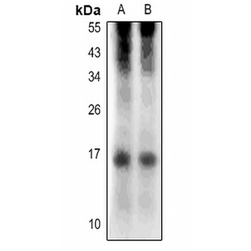 RNASE4 Rabbit Polyclonal Antibody