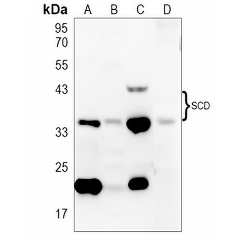 SCD Rabbit Polyclonal Antibody