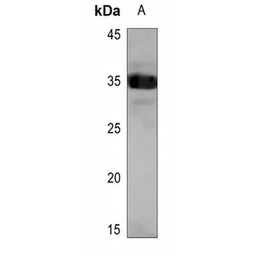 SCNM1 Rabbit Polyclonal Antibody