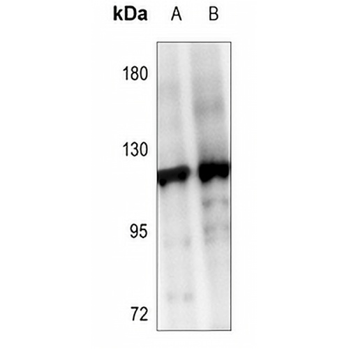 SENP6 Rabbit Polyclonal Antibody