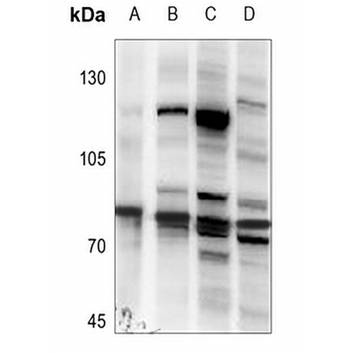 TBK1 Rabbit Polyclonal Antibody