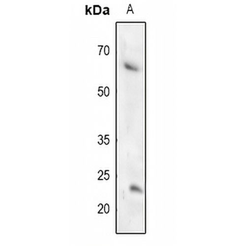 TFCP2L1 Rabbit Polyclonal Antibody