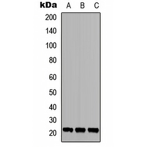 TGIF2LY Rabbit Polyclonal Antibody