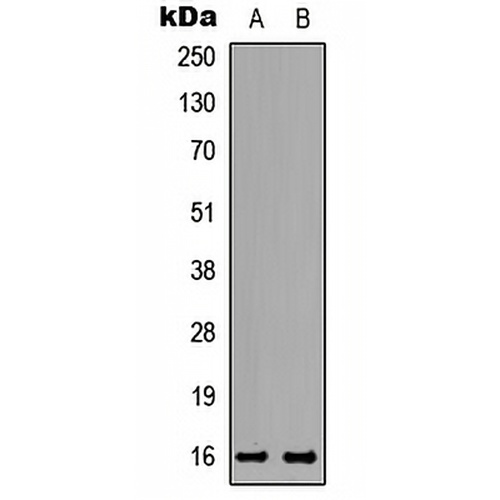 TNP2 Rabbit Polyclonal Antibody