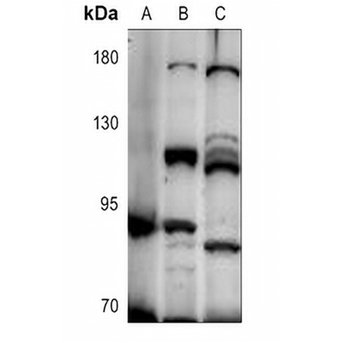 UNC5A Rabbit Polyclonal Antibody