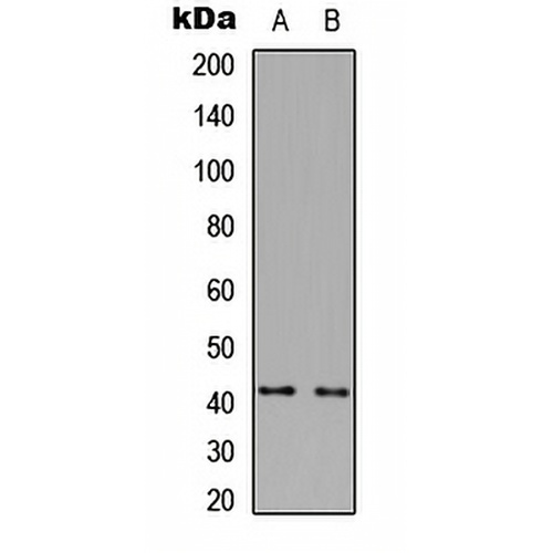 ZDHHC18 Rabbit Polyclonal Antibody