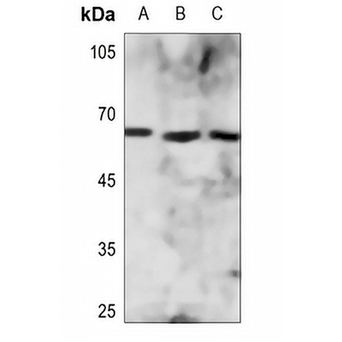 ZNF496 Rabbit Polyclonal Antibody