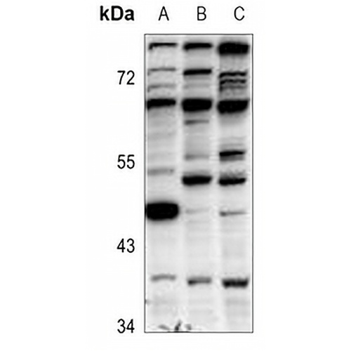 GFI1B Rabbit Polyclonal Antibody