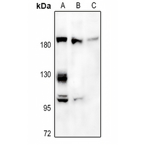 A2M Rabbit Polyclonal Antibody