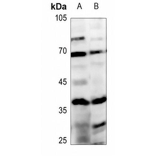 ABHD4 Rabbit Polyclonal Antibody