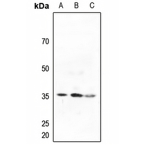 ACER2 Rabbit Polyclonal Antibody
