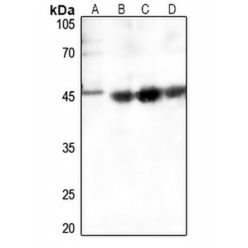Smooth Muscle Actin Rabbit Polyclonal Antibody