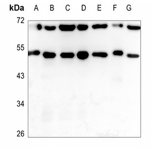 ADAMDEC1 Rabbit Polyclonal Antibody