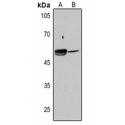 ALDH1A1 Rabbit Polyclonal Antibody