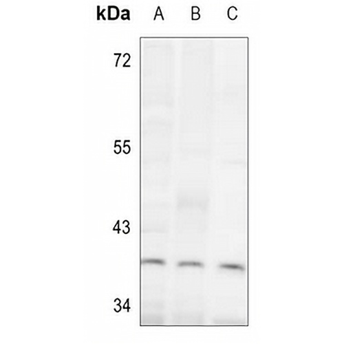 ALDOC Rabbit Polyclonal Antibody