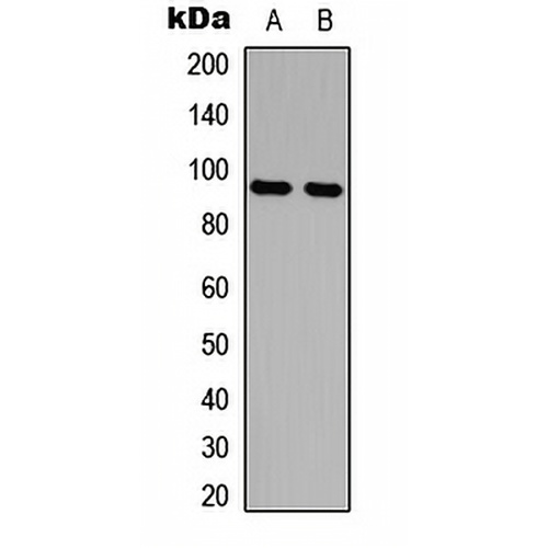 AMPD2 Rabbit Polyclonal Antibody