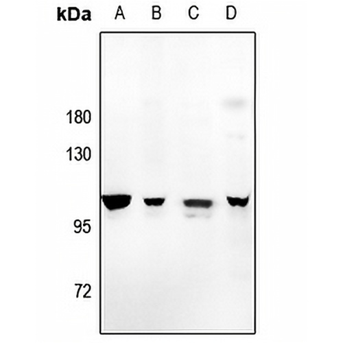 Amphiphysin 1 Rabbit Polyclonal Antibody