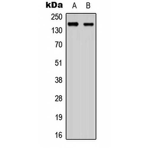ANKRD30A Rabbit Polyclonal Antibody