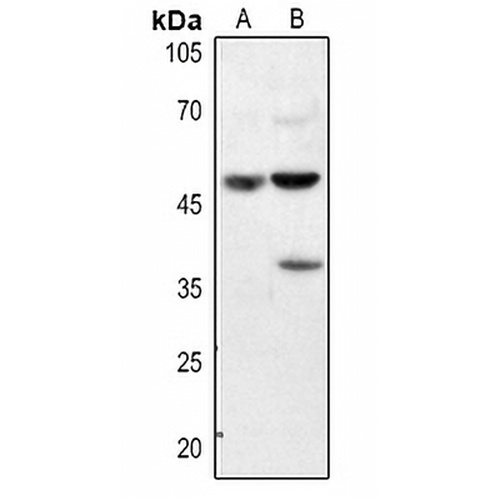 Annexin A7 Rabbit Polyclonal Antibody