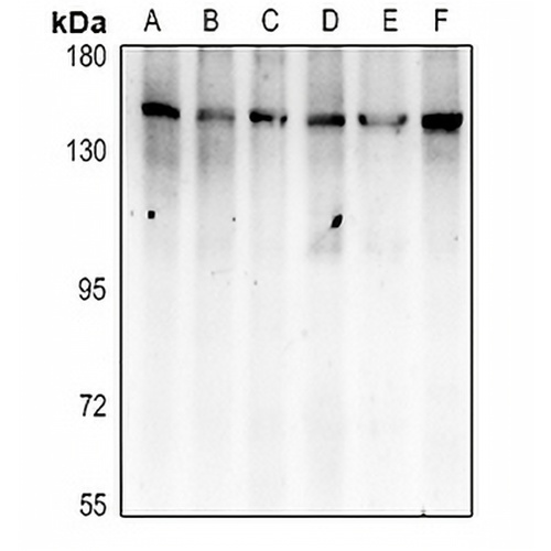 APAF-1 Rabbit Polyclonal Antibody