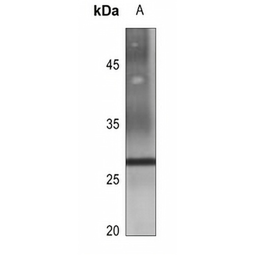 Aquaporin 2 Rabbit Polyclonal Antibody