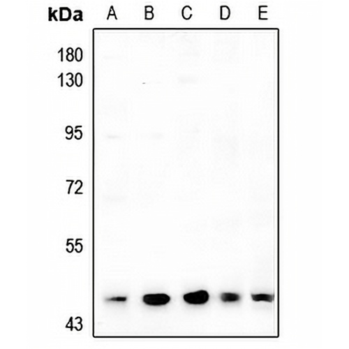 ARRDC4 Rabbit Polyclonal Antibody