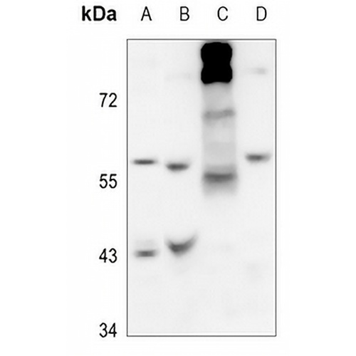 Arylsulfatase B Rabbit Polyclonal Antibody