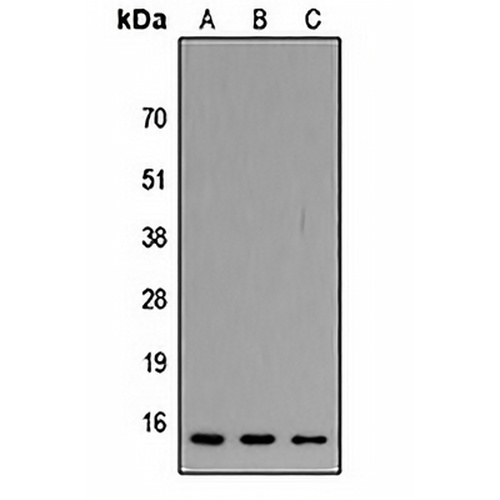 ATP5JL Rabbit Polyclonal Antibody