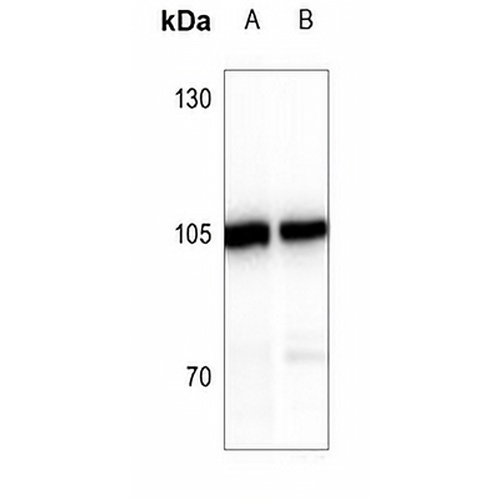 ATP6V0A2 Rabbit Polyclonal Antibody