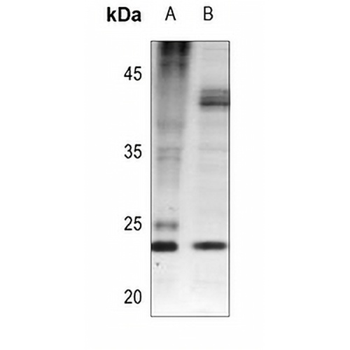 BAD (Phospho-S112) Rabbit Polyclonal Antibody