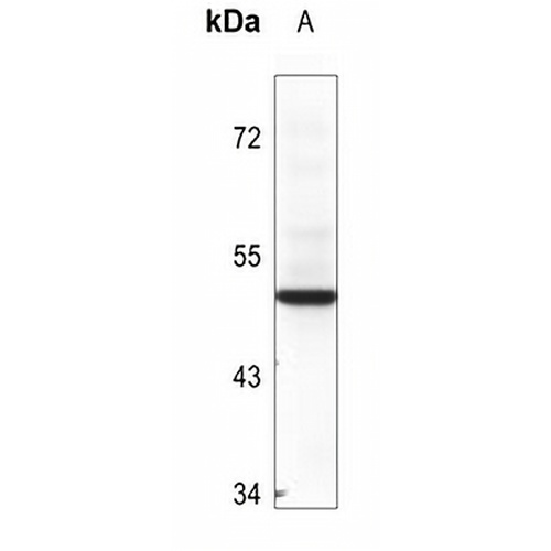 BAG1 Rabbit Polyclonal Antibody