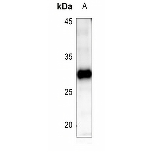 BCL2 Rabbit Polyclonal Antibody