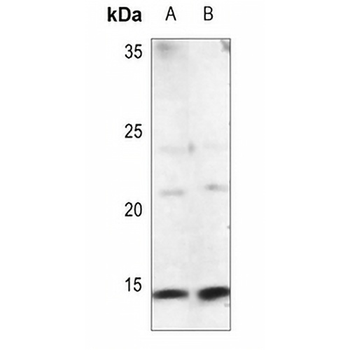 Procalcitonin Rabbit Polyclonal Antibody