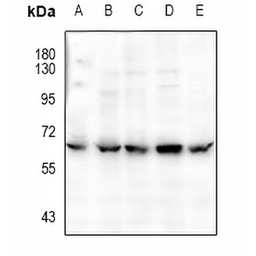 CaMK2 alpha/delta (Phospho-T286) Rabbit Polyclonal Antibody
