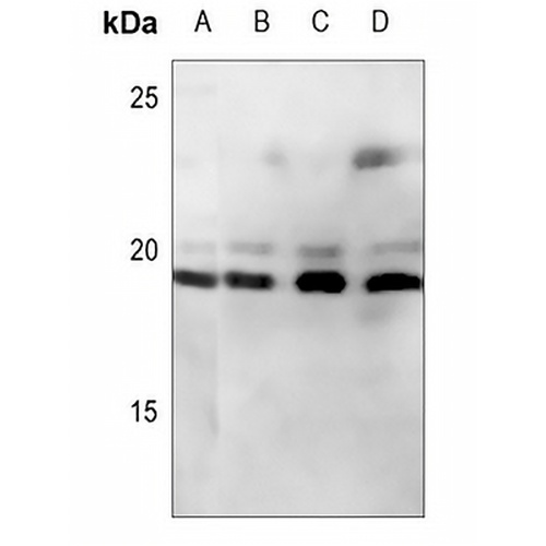 CD247 Rabbit Polyclonal Antibody
