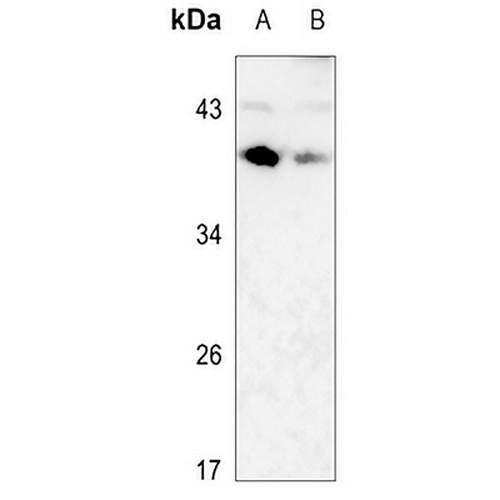 CD79b Rabbit Polyclonal Antibody