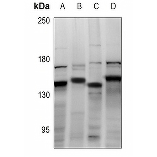 CDCA2 Rabbit Polyclonal Antibody