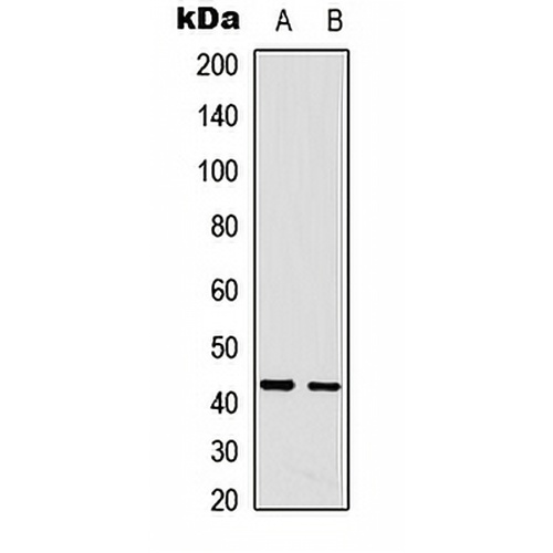 CDCA7 Rabbit Polyclonal Antibody