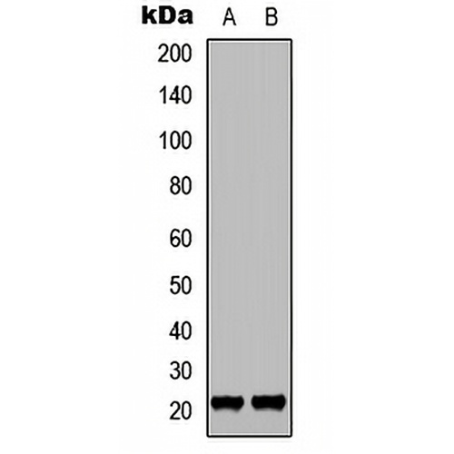 p21 (Phospho-T145) Rabbit Polyclonal Antibody