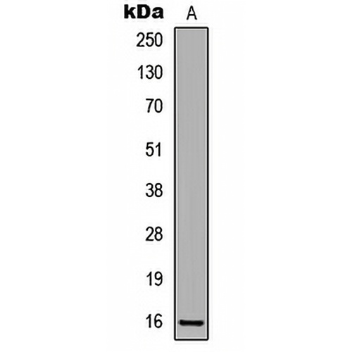 p16 INK4a (Phospho-S152) Rabbit Polyclonal Antibody