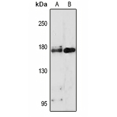 CD66e Rabbit Polyclonal Antibody