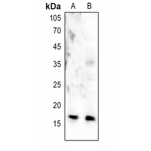 CENPA Rabbit Polyclonal Antibody