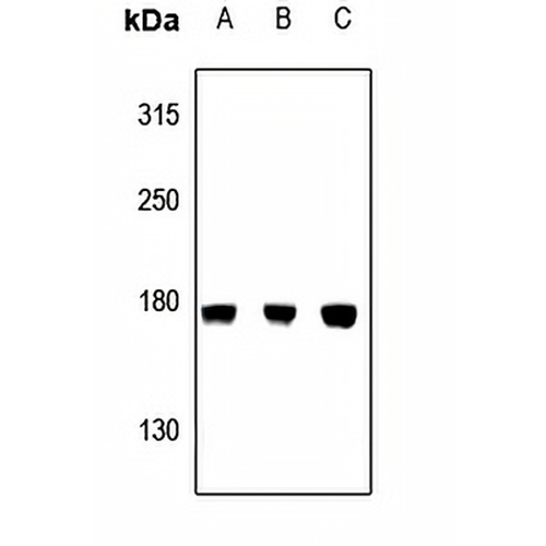 CEP170 Rabbit Polyclonal Antibody
