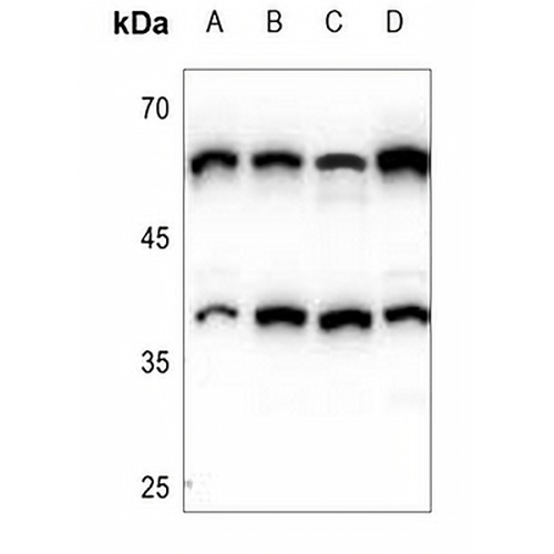 CERKL Rabbit Polyclonal Antibody