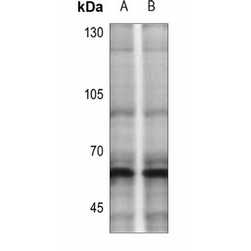 CHK2 (Phospho-T383) Rabbit Polyclonal Antibody