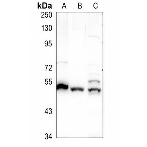 CHST6 Rabbit Polyclonal Antibody