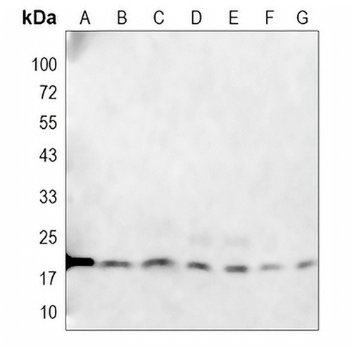 Claudin 3 Rabbit Polyclonal Antibody