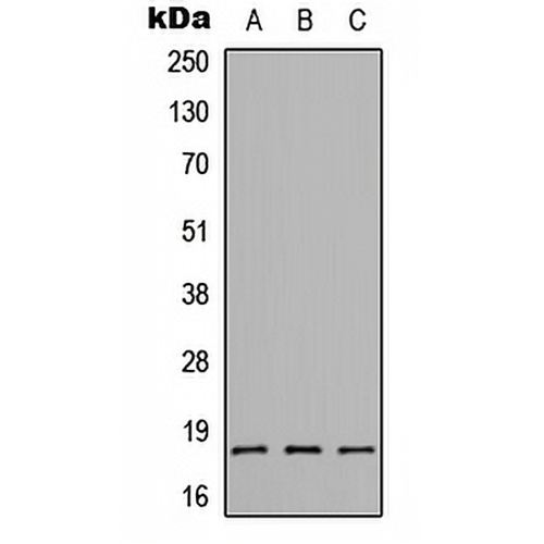 CMTM1 Rabbit Polyclonal Antibody
